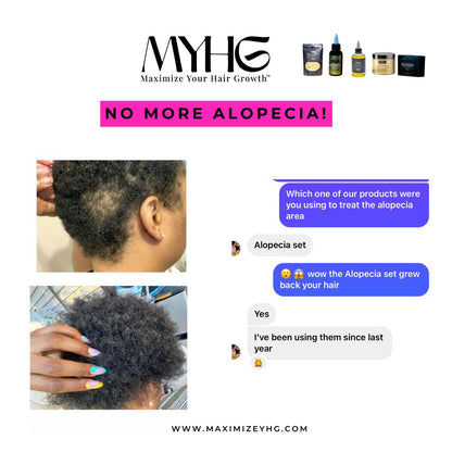 Beat Alopecia Bundle