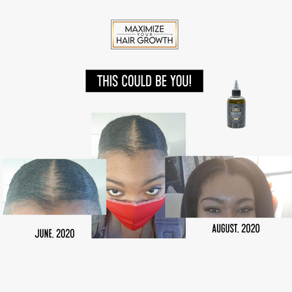 Miracle Hair Growth Oil