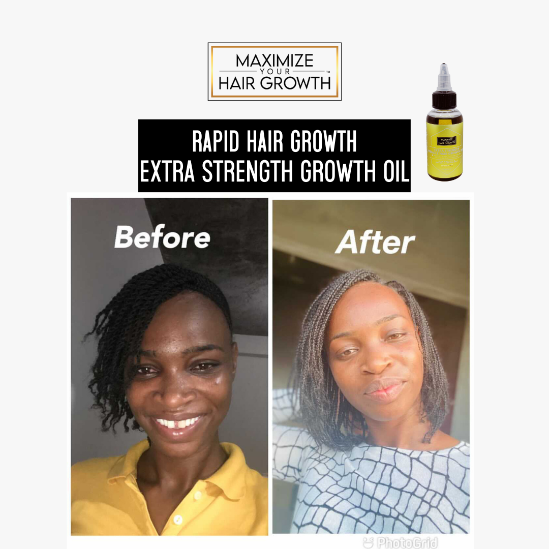 ONE EXTRA STRENGTH MIRACLE HAIR GROWTH OIL 2oz