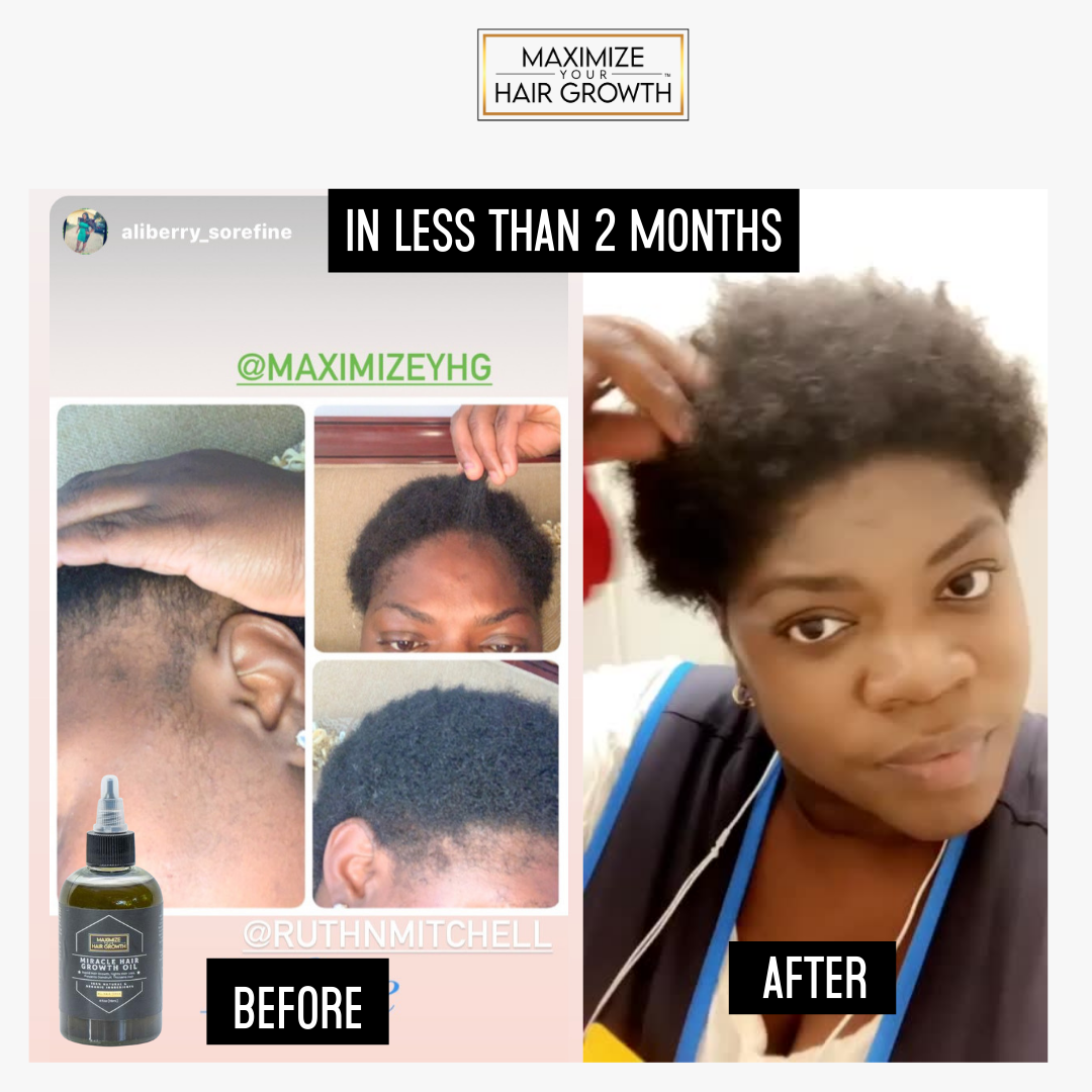 Miracle Hair Growth Oil