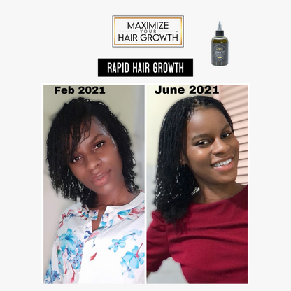 Miracle Hair Growth Oil