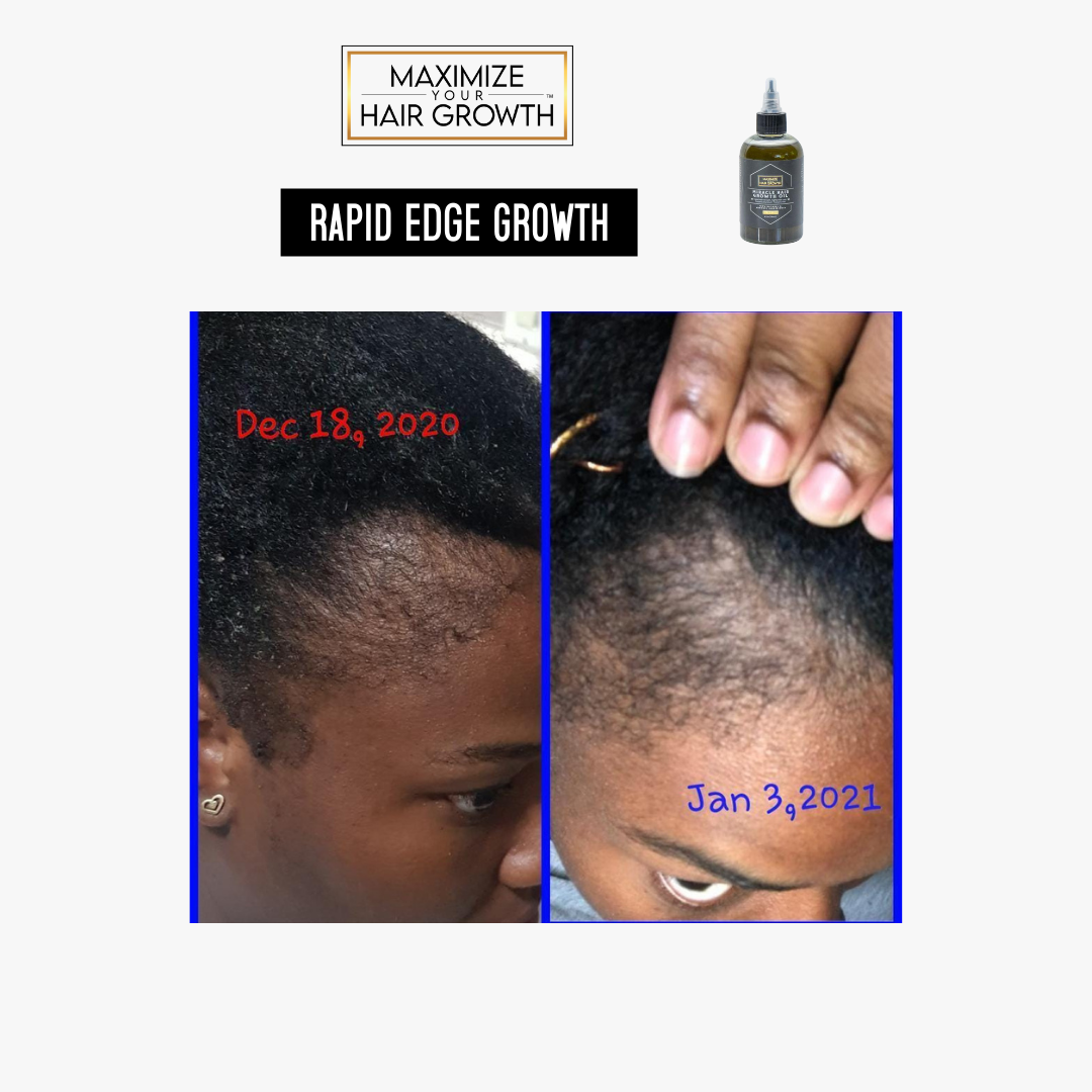 Miracle Hair Growth Oil