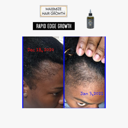 Miracle Hair Growth Oil