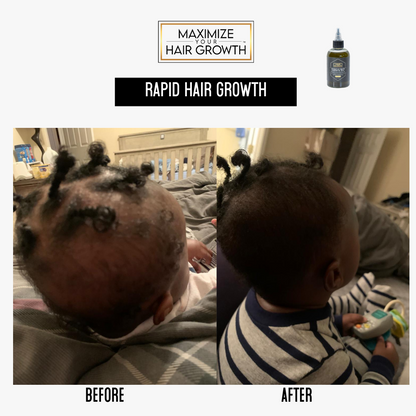 Miracle Hair Growth Oil